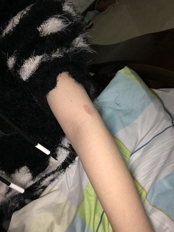 你见过什么特殊的胎记?