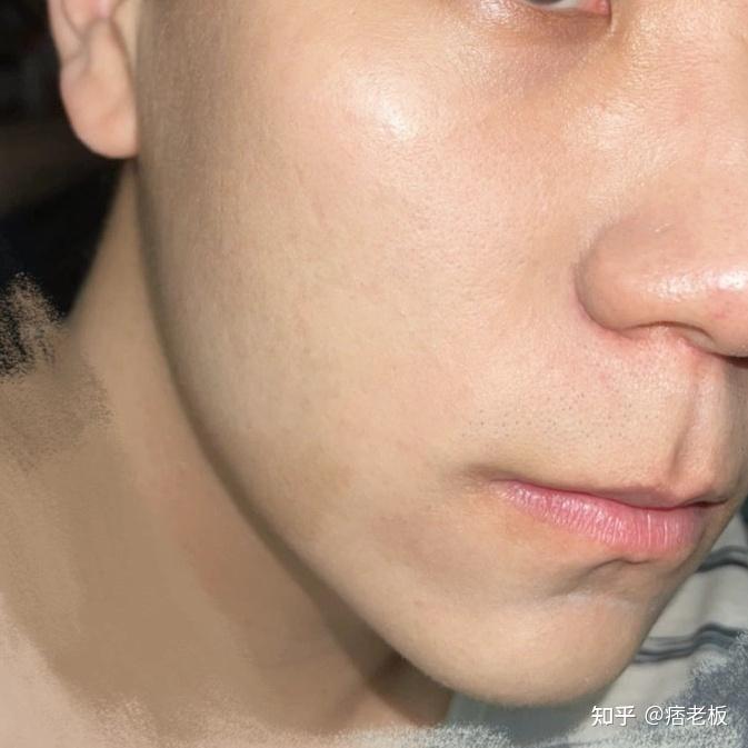 男生美白 zhuanlan.zhihu.com