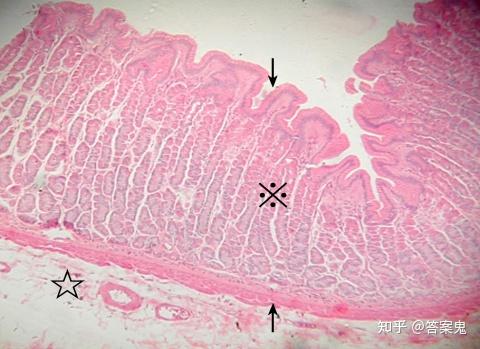 圖12-10胃底部(胃 he染色10×4) 圖示胃壁的粘膜單層柱狀上皮下陷形成