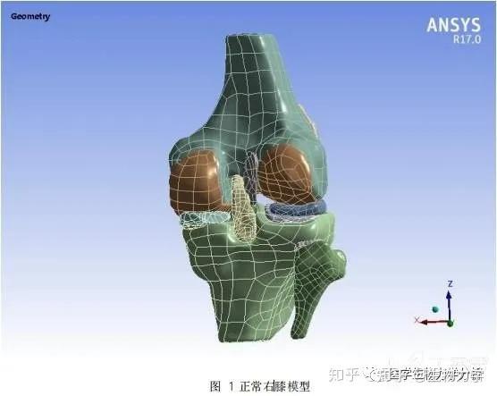 膝關節有限元分析靜力分析