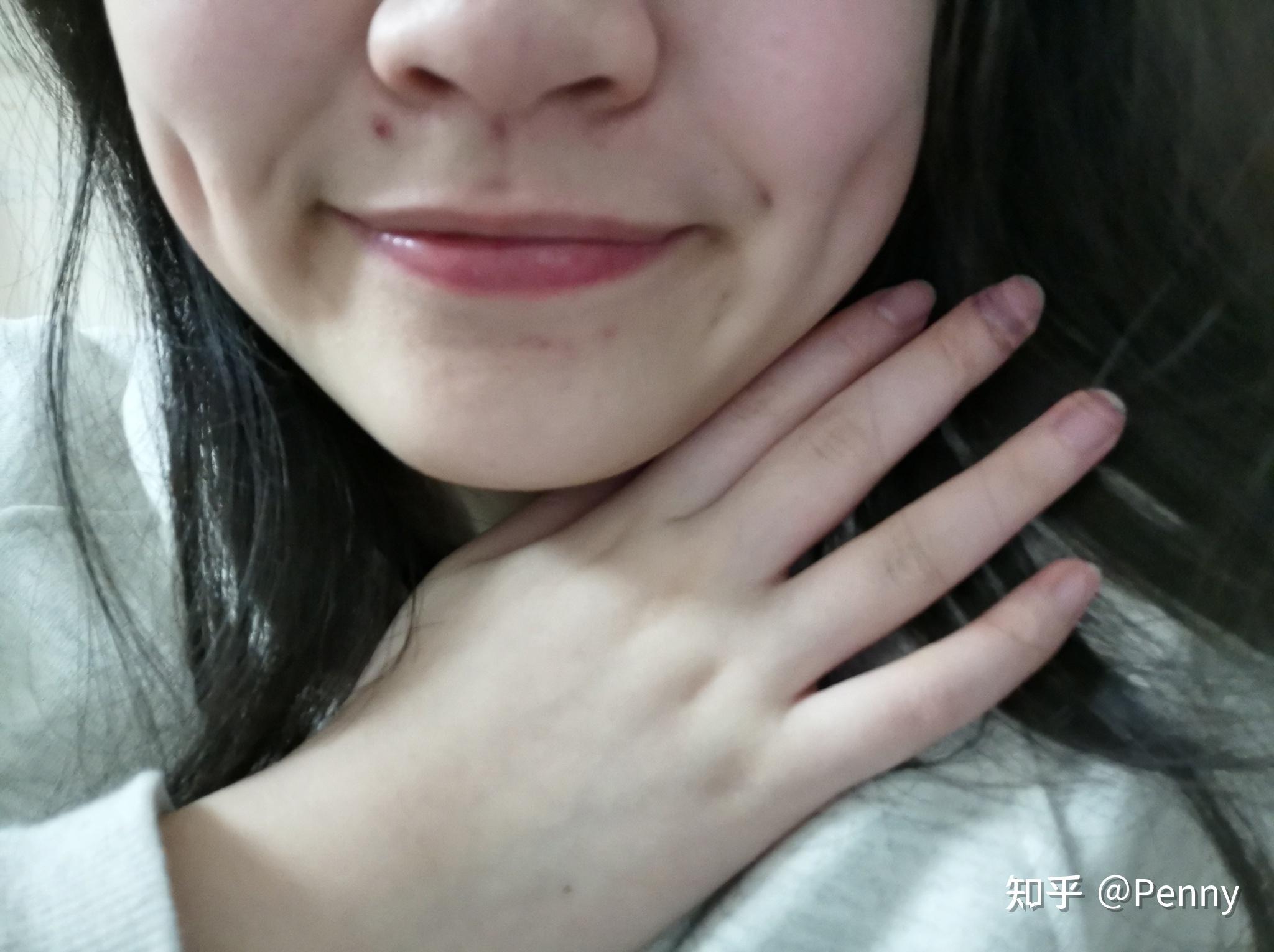 还有人脸上有2个酒窝,4个梨涡吗可怕? - 知乎