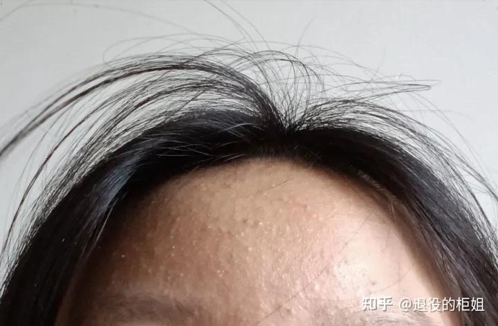 面膜泥推荐有没有什么面膜泥可以去黑头闭口比较有效的要适合油皮的