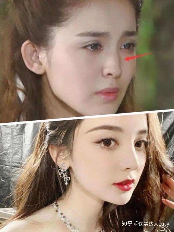 新疆美女如云却都有一个共同点好看的鼻子