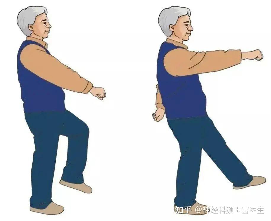 帕金森患者步行训练：3个动作+2个辅助工具，降低跌倒风险 - 知乎