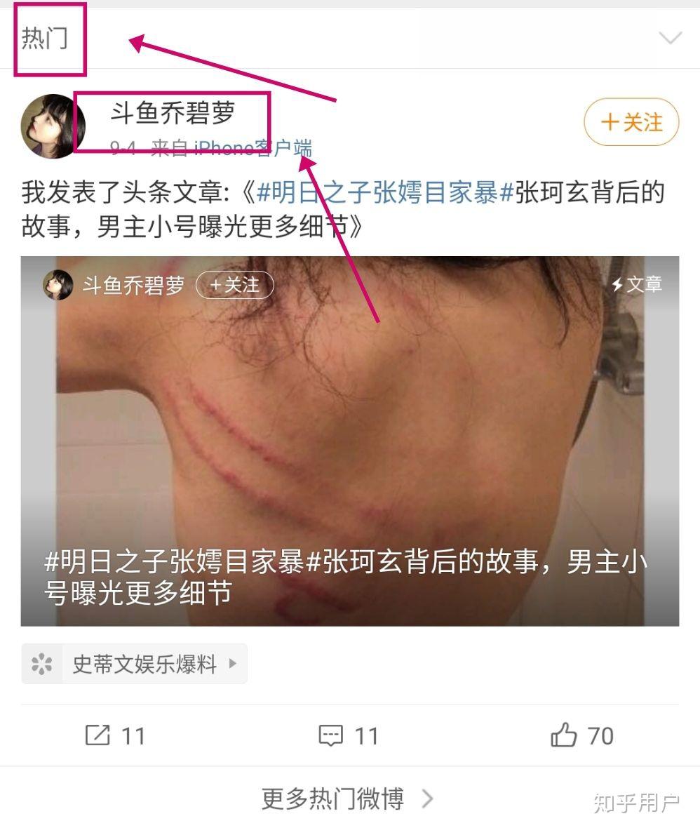 张嫮目事件图片