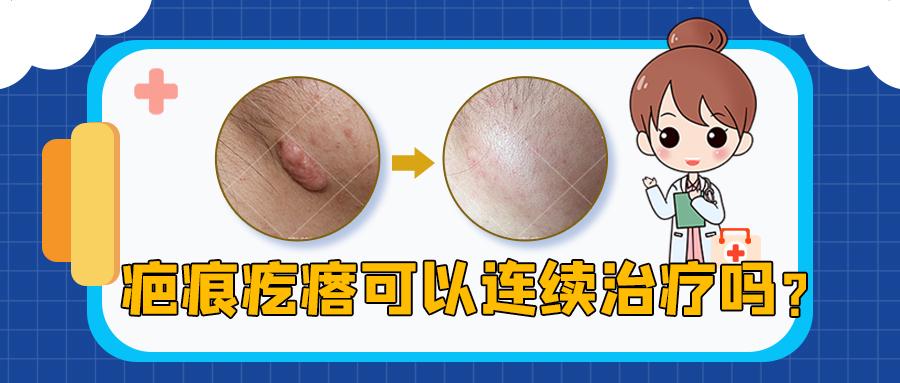 v2-be36095db8e2c9d320ce0f8b062ec60c_1440w.jpg?source=172ae18b
