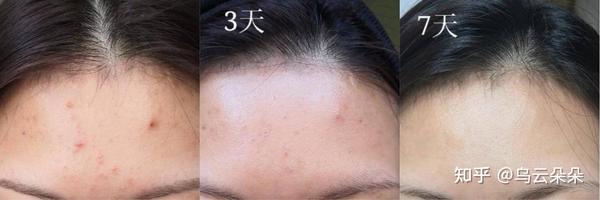 26岁干性皮肤女人如何保养护肤_开护肤保养_护肤保养开课啦