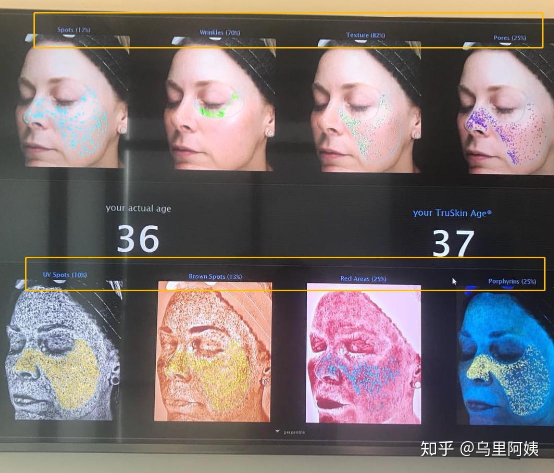 VISIA 第7代全能皮肤分析仪 - NuMe名人美學概念