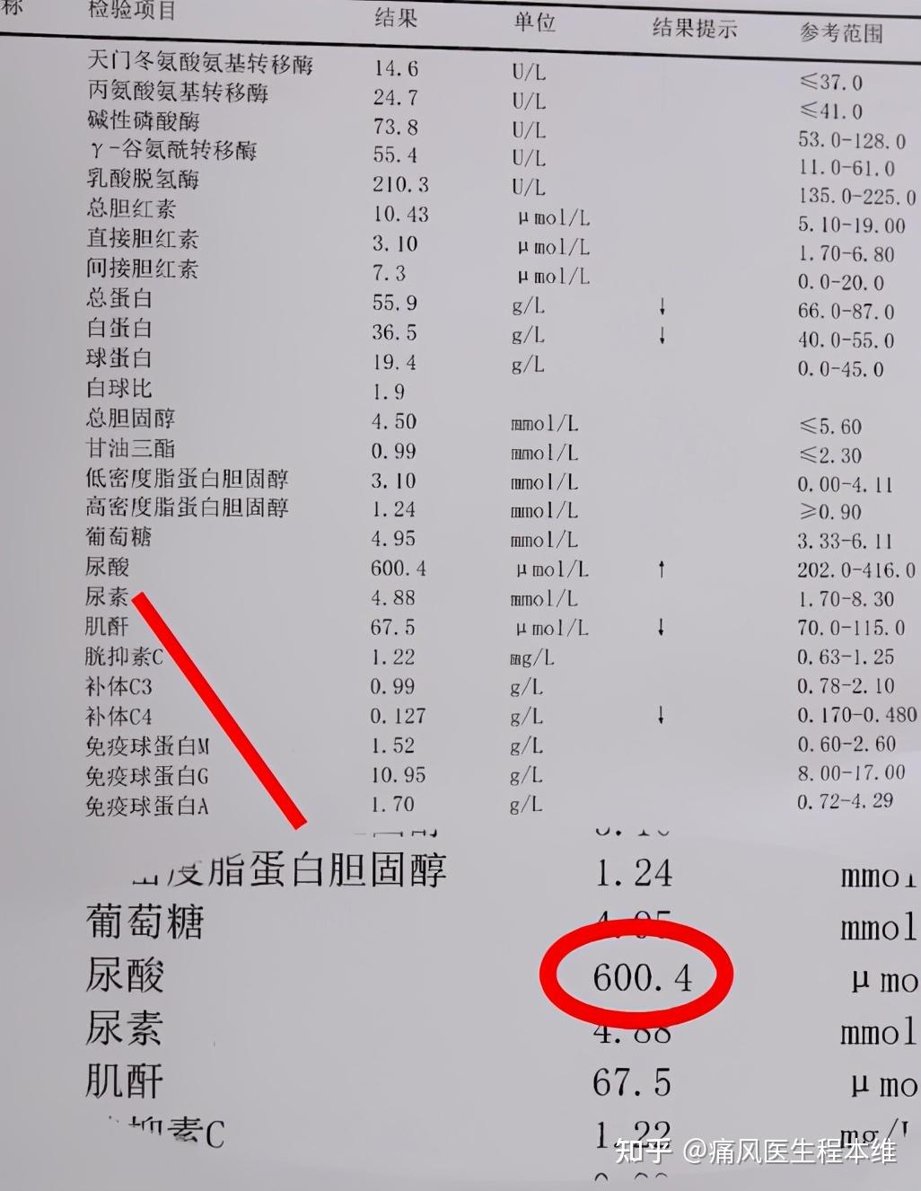 这是他刚来时的检查单,你看这个尿酸都已经这么高了600.
