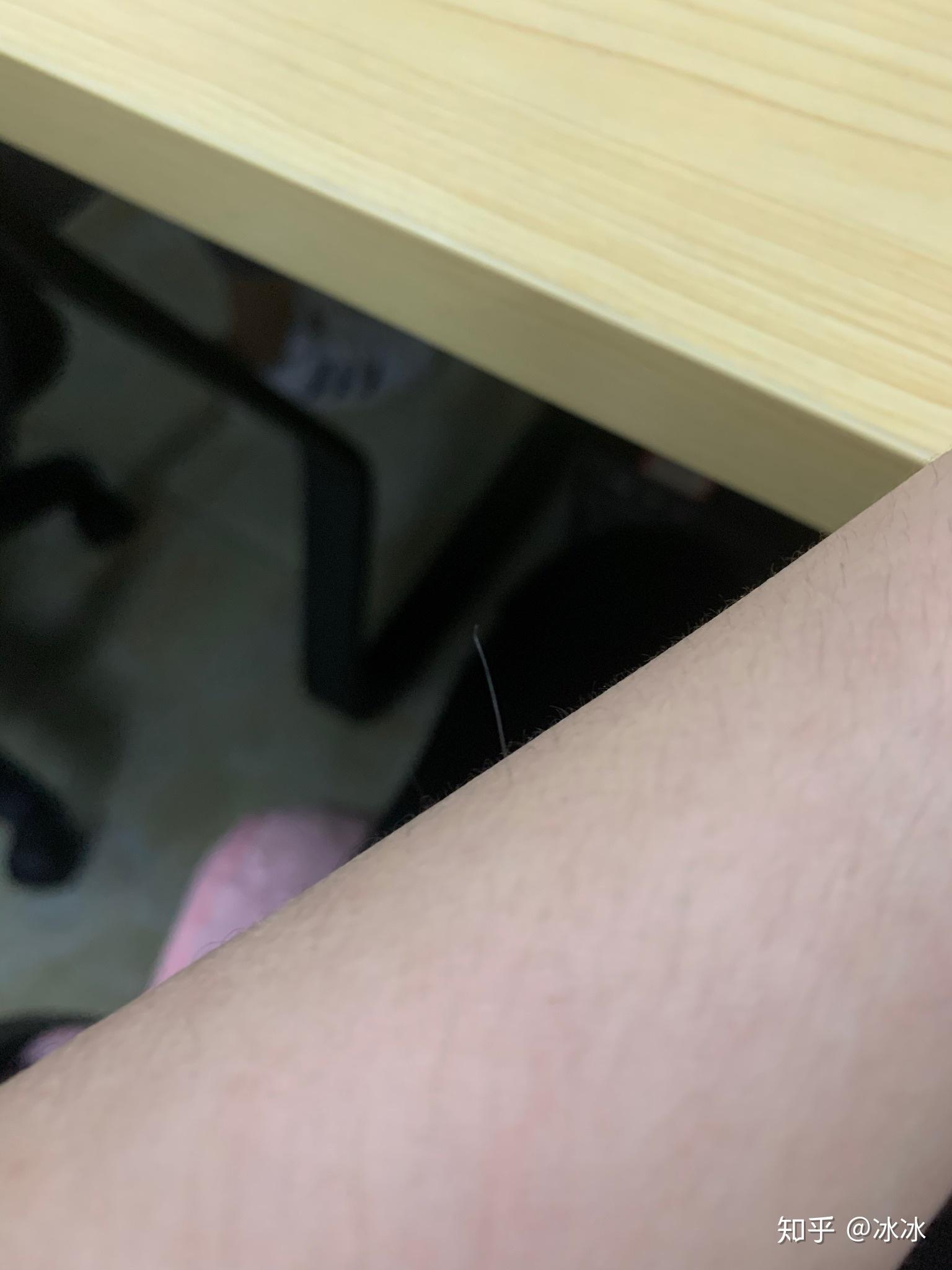 同学脸上长了一根长长的白毛shi活不让我拔请问这个是什么怎么来的