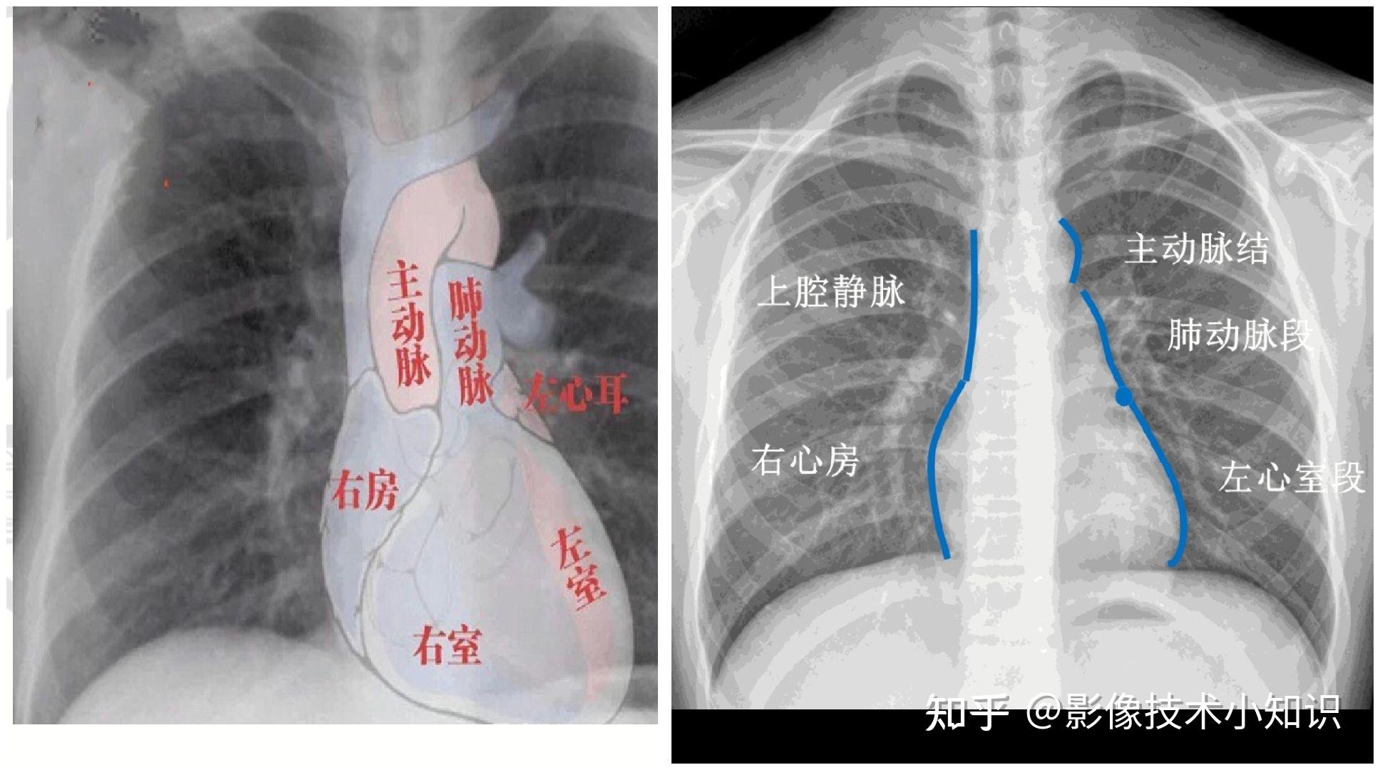 心脏的影像知识（2） - 知乎
