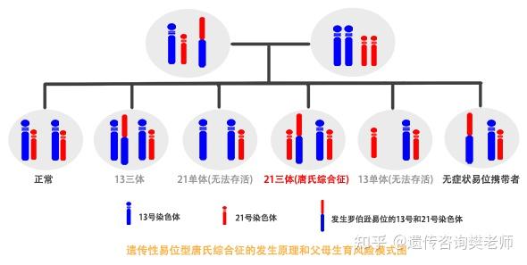 罗氏易位 平衡易位的特殊形式 罗伯逊易位