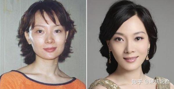 我们来看看陈数整容前后的照片对比,简直可以用判若两人来形容.
