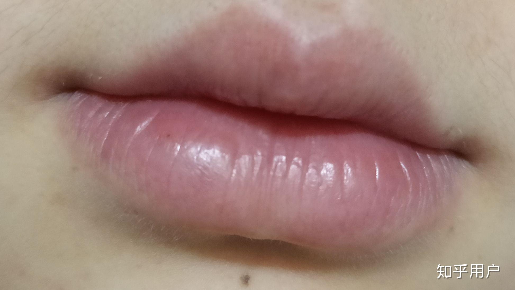 嘴巴难看是一种怎样的体验