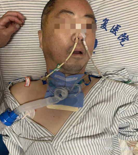 康养帮对接康复医院对颅脑损伤患者进行康复治疗帮助患者破茧成蝶