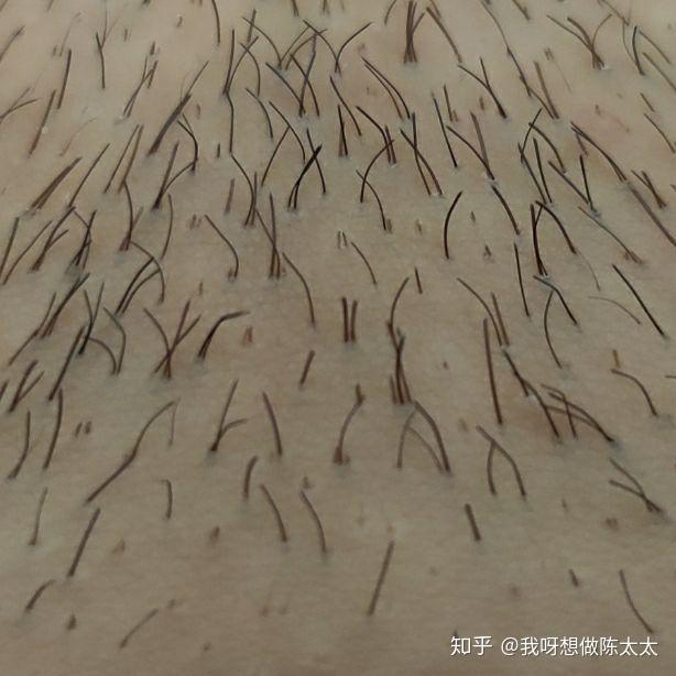 jovs脱毛仪实测(仅姐妹可进)