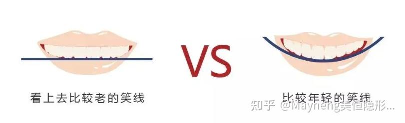 get到窍门还用担心笑起来不好看？ - 知乎