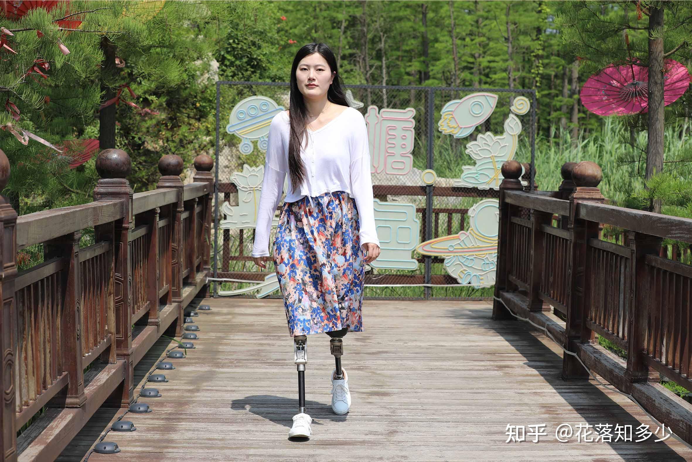 重庆康心医院康复中心 助偏瘫患者摆脱轮椅 - 重庆康心医院