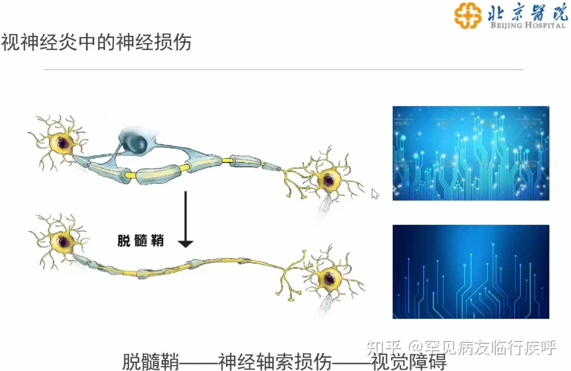 轴索再生图片