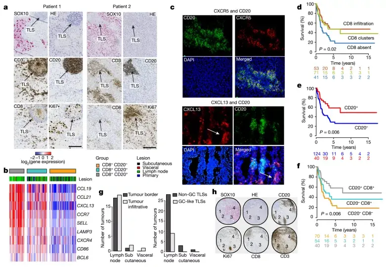 文献解读丨DSP空间蛋白解析黑色素瘤三级淋巴结构 - 知乎
