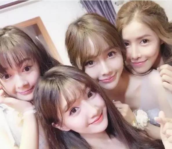 圆脸别瞎折腾！看谭松韵赵露思打针后效果对比，自然更耐看