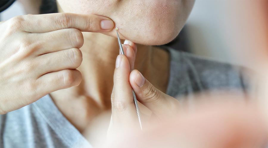 怎样才能去除痘痘和黑头 v2-c0960e94e2888a03c49075bedfe08a51_1440w.jpg