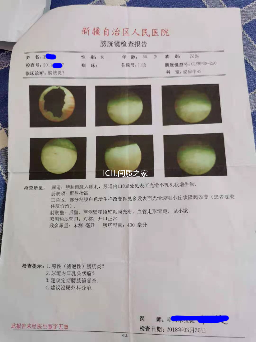 尿路感染也会发展成不死的癌症间质性膀胱炎