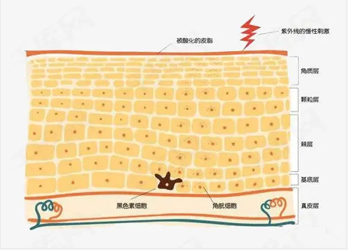 浅谈自体表皮干细胞在伤口管理中的应用 - 知乎