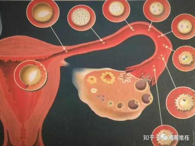 碘油造影那点事儿系列一 - 知乎