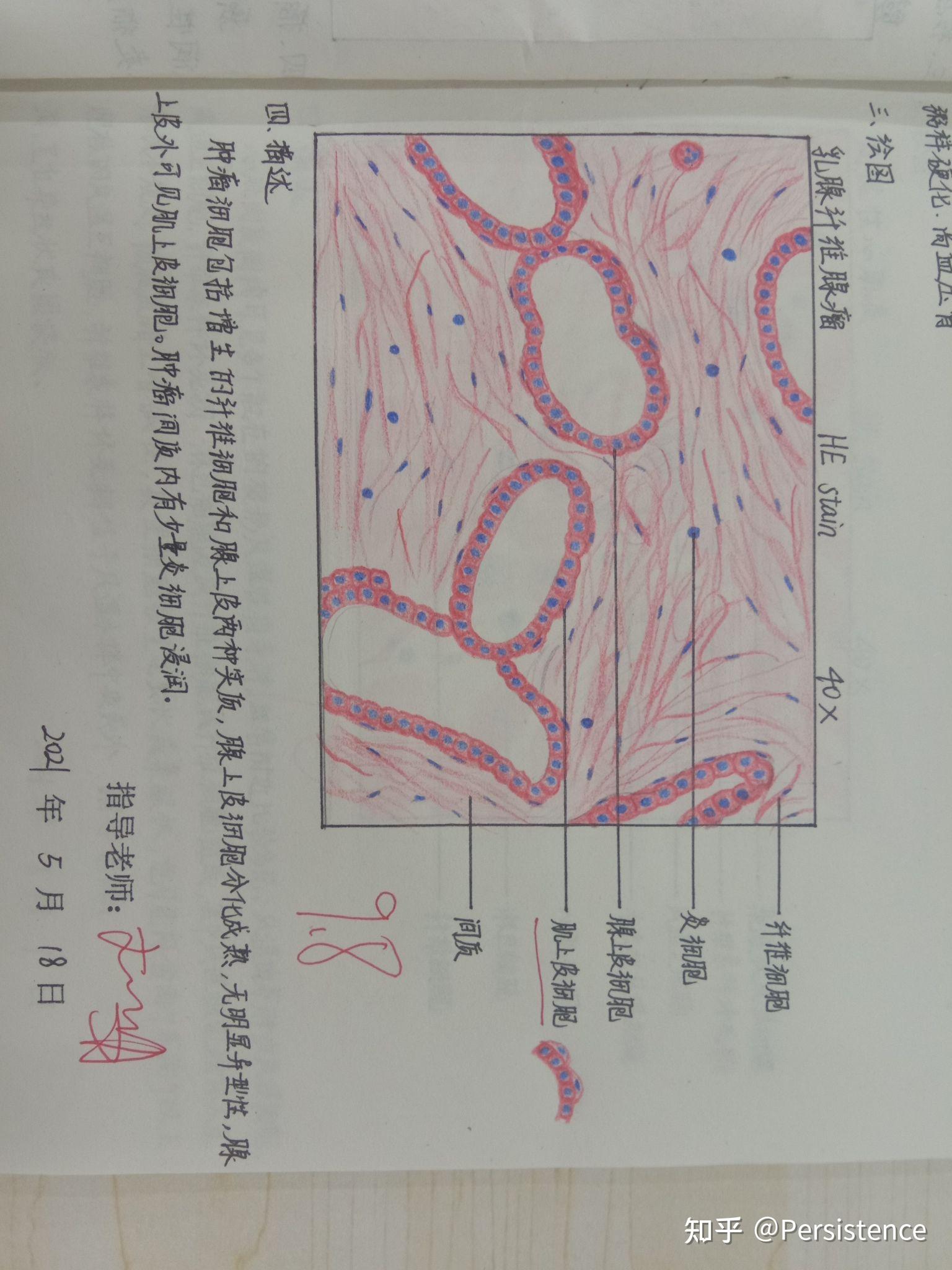 病理學紅藍鉛筆手繪圖