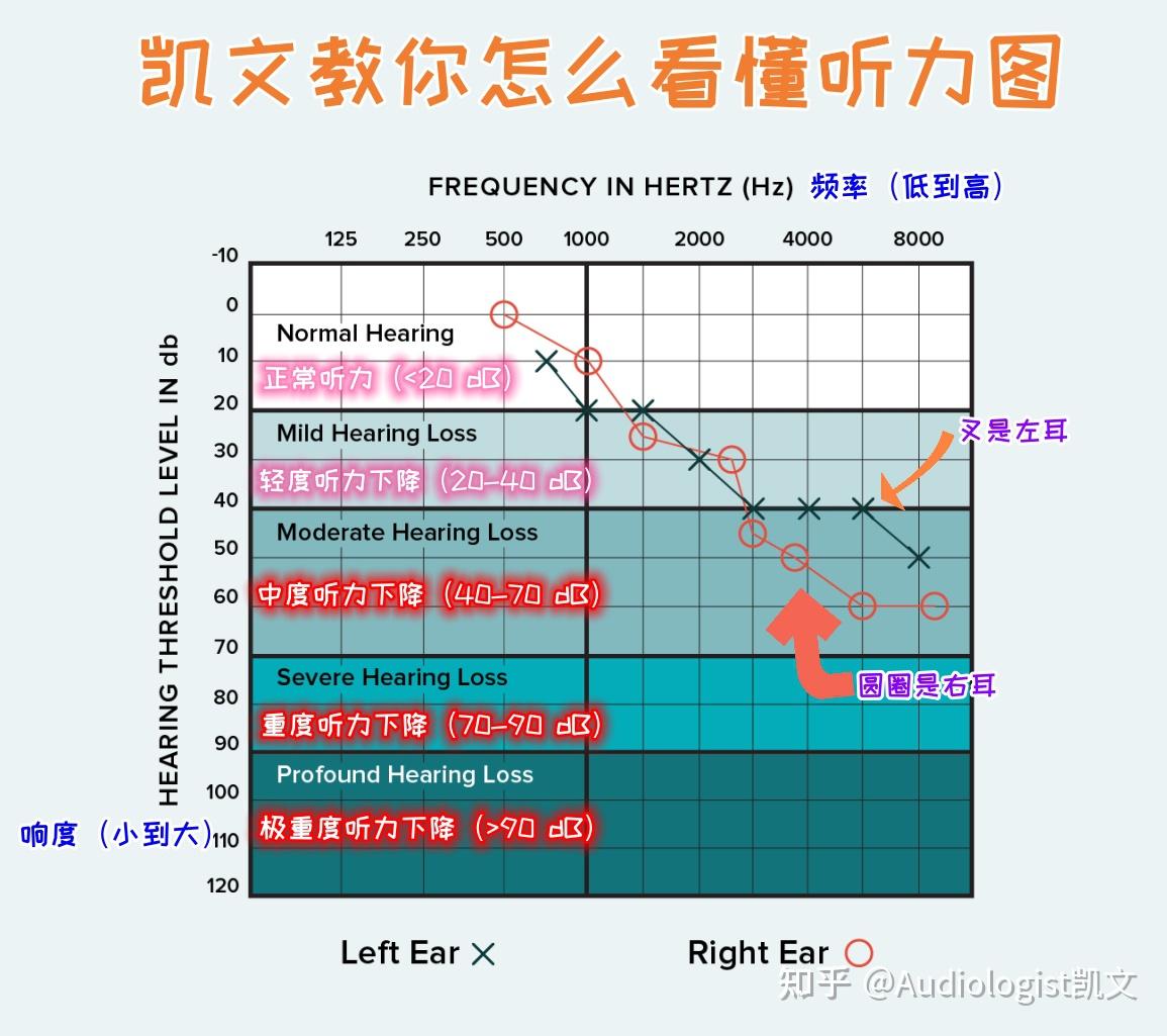 如何看懂听力检查报告！快来看看吧～