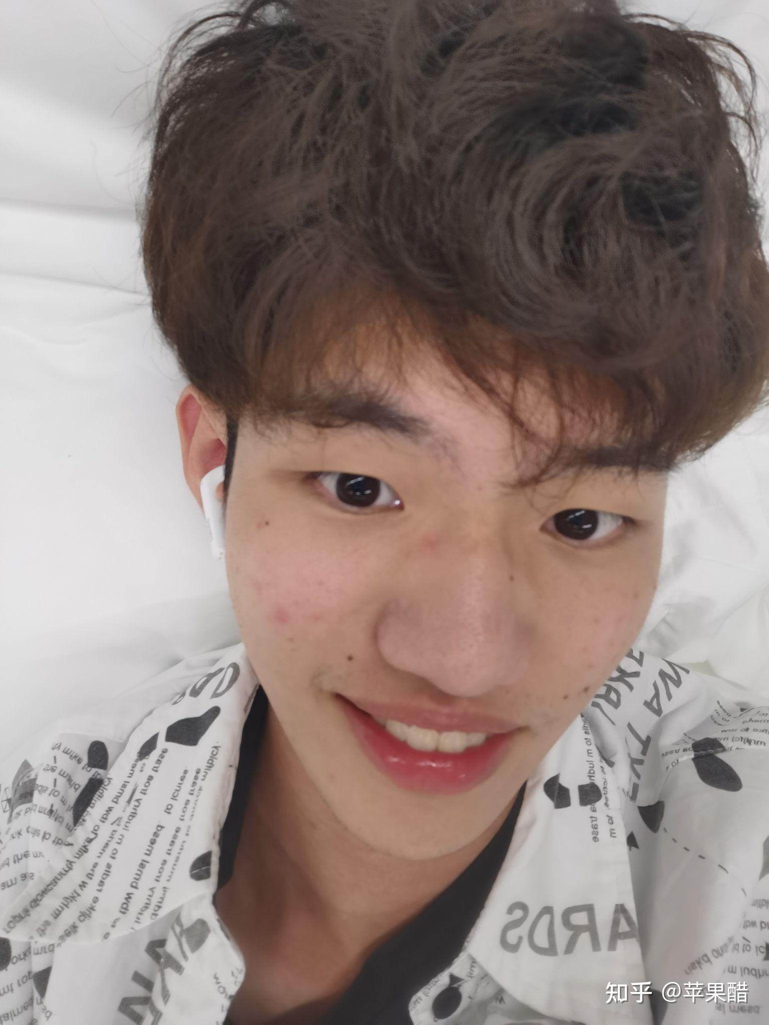 嘴唇厚的男生真的很丑吗