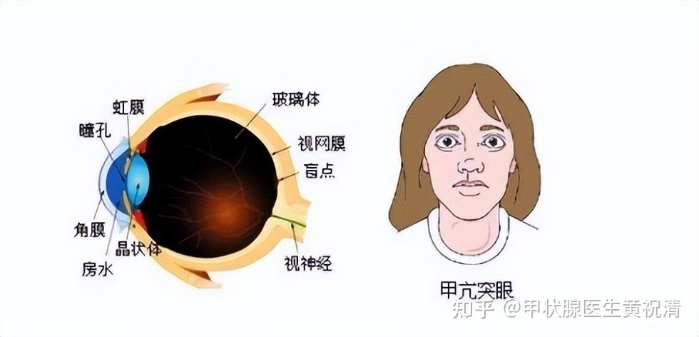 眼睛畏光、流泪、有异物感？注意！你可能是患上了这种疾病！ - 知乎