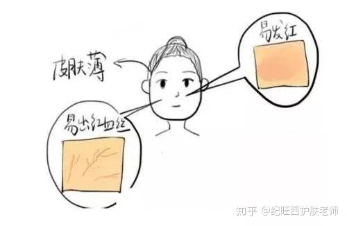 怎样让自己不要太敏感 v2-c12ac94a2423a3f8dde8defb9d4fde09_r.jpg