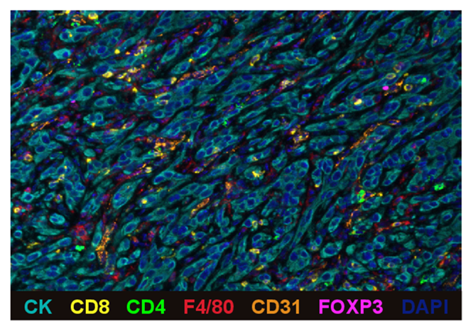 多色免疫荧光助力肿瘤免疫微环境研究之系列专题七——肺癌 - 知乎