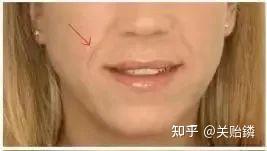 法令纹的女人面相科普大全 从法令纹看女性的命运 - 知乎