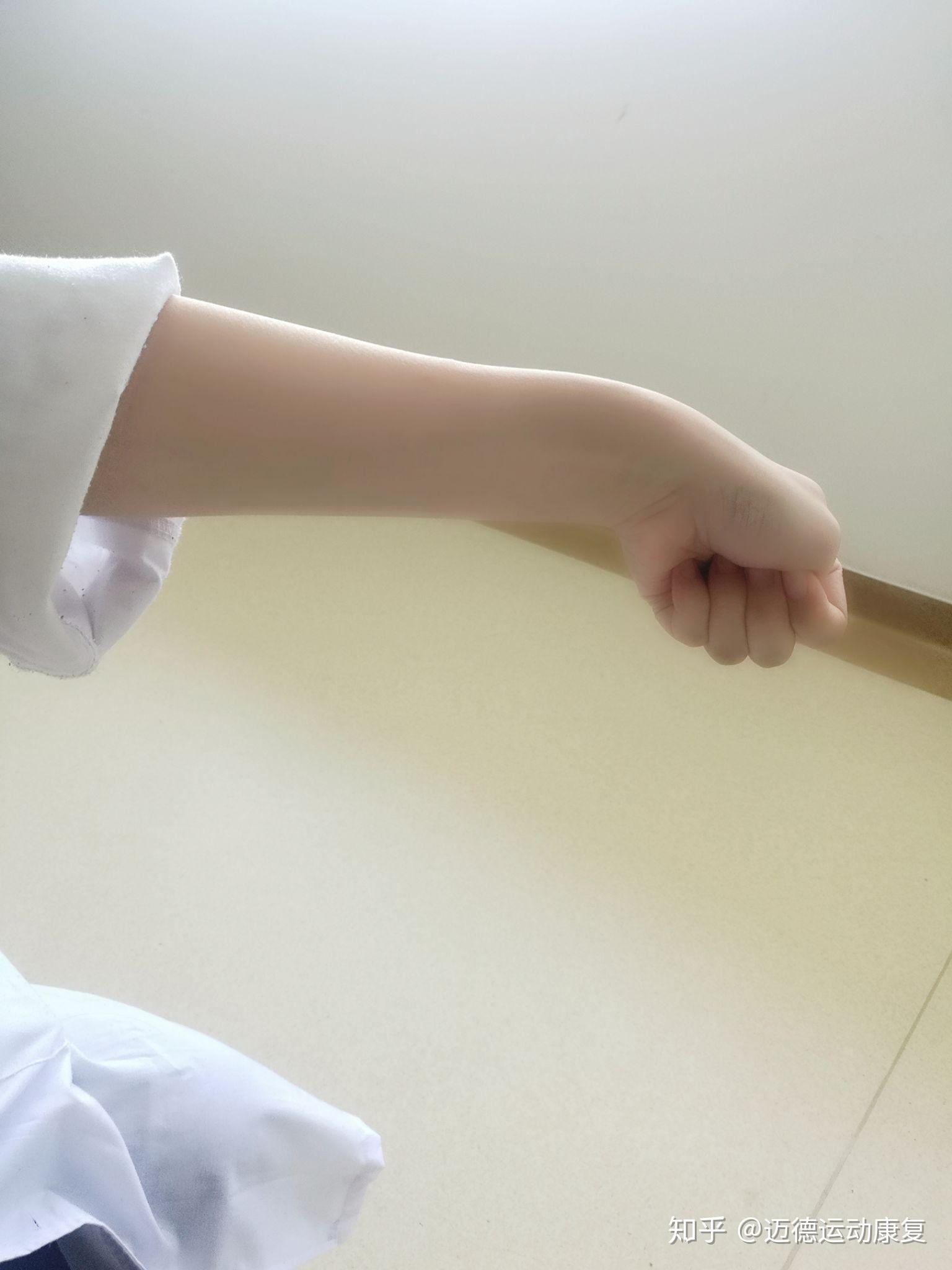 带娃总喊手腕疼,原来是"妈妈手"惹得祸 - 知乎