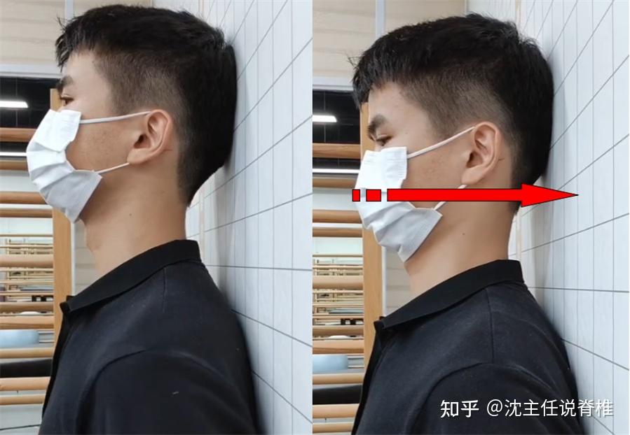 头前伸、含胸驼背怎么办？4个动作帮你快速改善 - 知乎