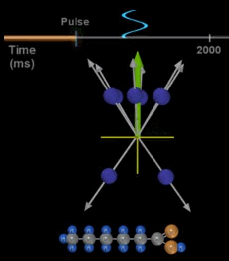 脑成像技术之核磁共振