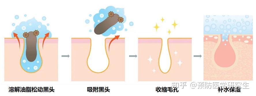 专业医生保姆级去黑头方法!千万别用暴力方式去黑头了,安全去黑头仅需4步,一个月养成牛奶鼻!拒交智商税! - 知乎