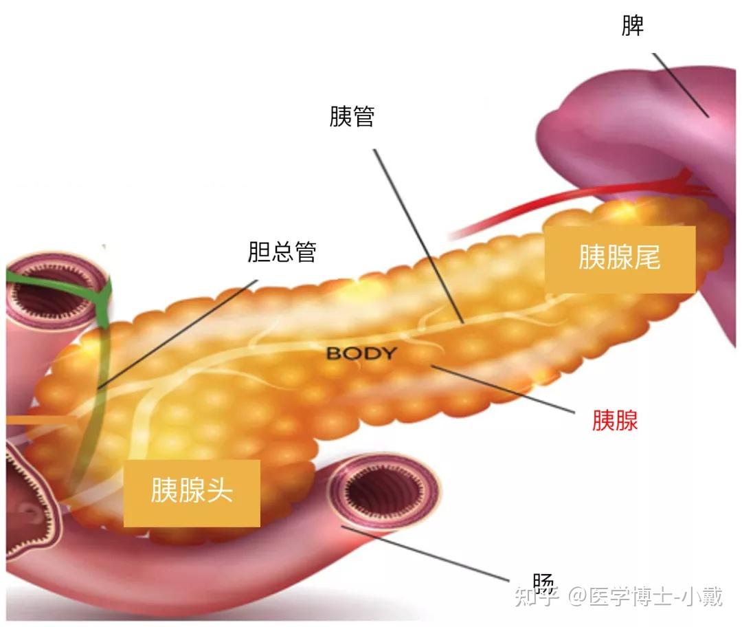 “癌中之王”的胰腺癌，你真的了解吗？ - 知乎