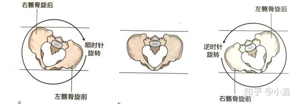 骨盆侧倾与旋转