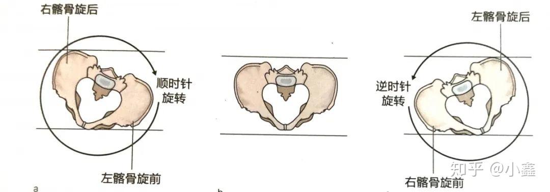 骨盆侧倾与旋转