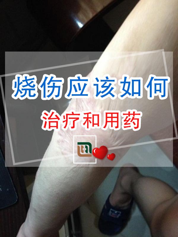 水烧伤皮肤怎么处理 v2-c27c82de722e10a1bd1ba9fb407d2aa0_1440w.jpg?source=172ae18b