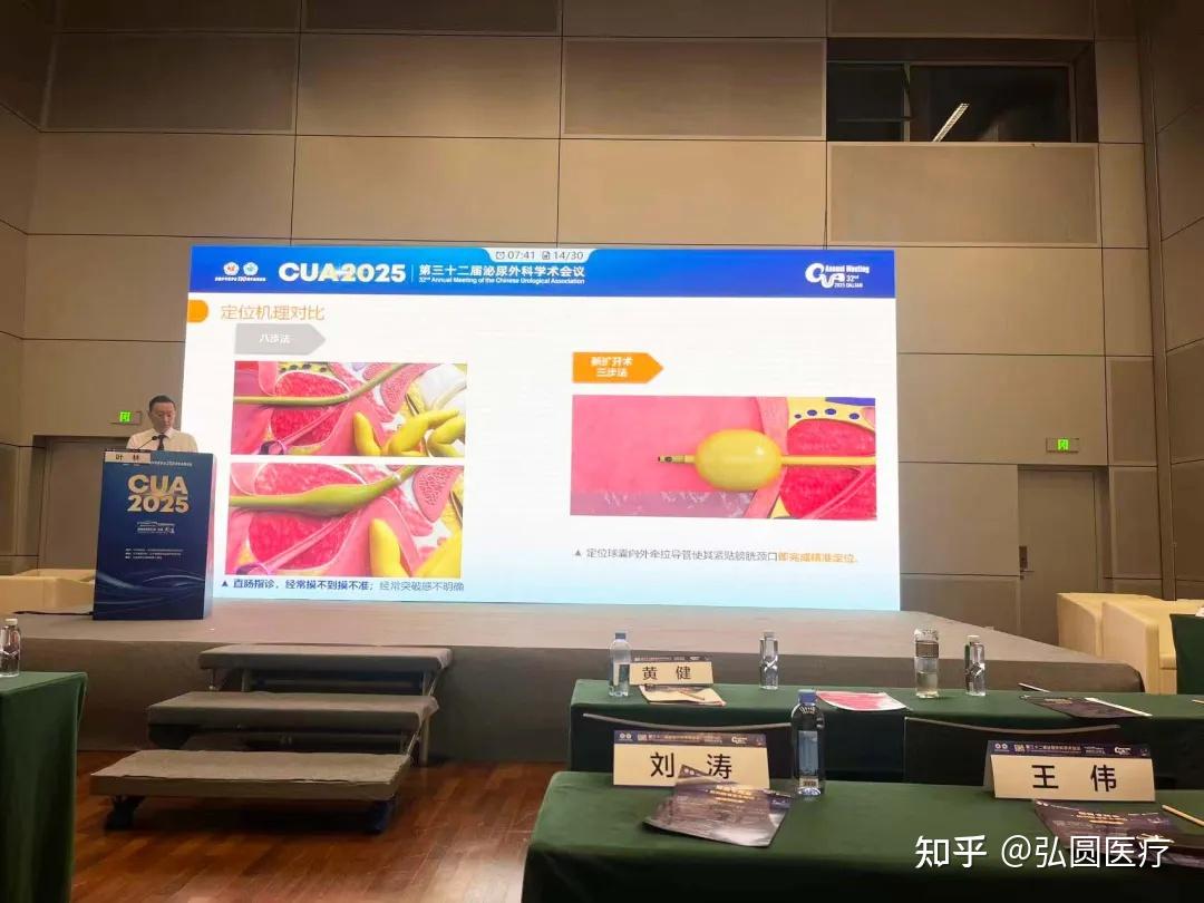 聚焦 CUA 2025 | 叶林教授解读前列腺扩开术技术革新,为 BPH 治疗注入新活力 - 知乎