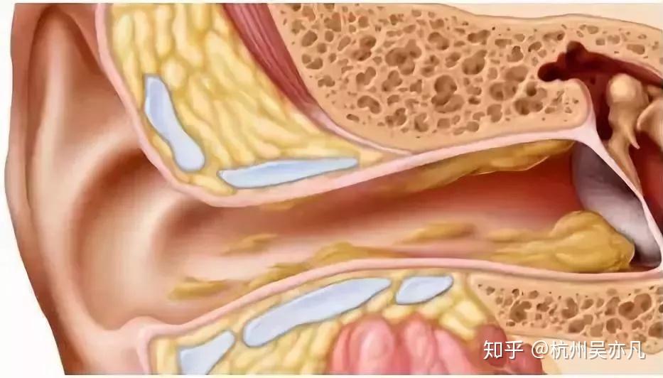 耳屎是怎么形成的图片