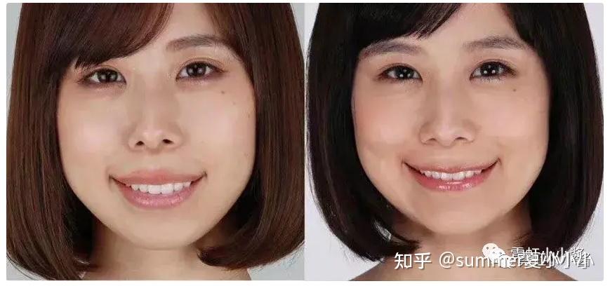 长脸变短、大脸变小、歪脸变正,它才是颜值升级第一站 - 知乎