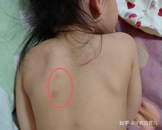 【宝妈家务必看】除螨仪是智商税吗?丨有必要买除螨仪吗?丨2026除螨仪推荐丨友望太阳光增强版除螨仪如何实现“家务外包”