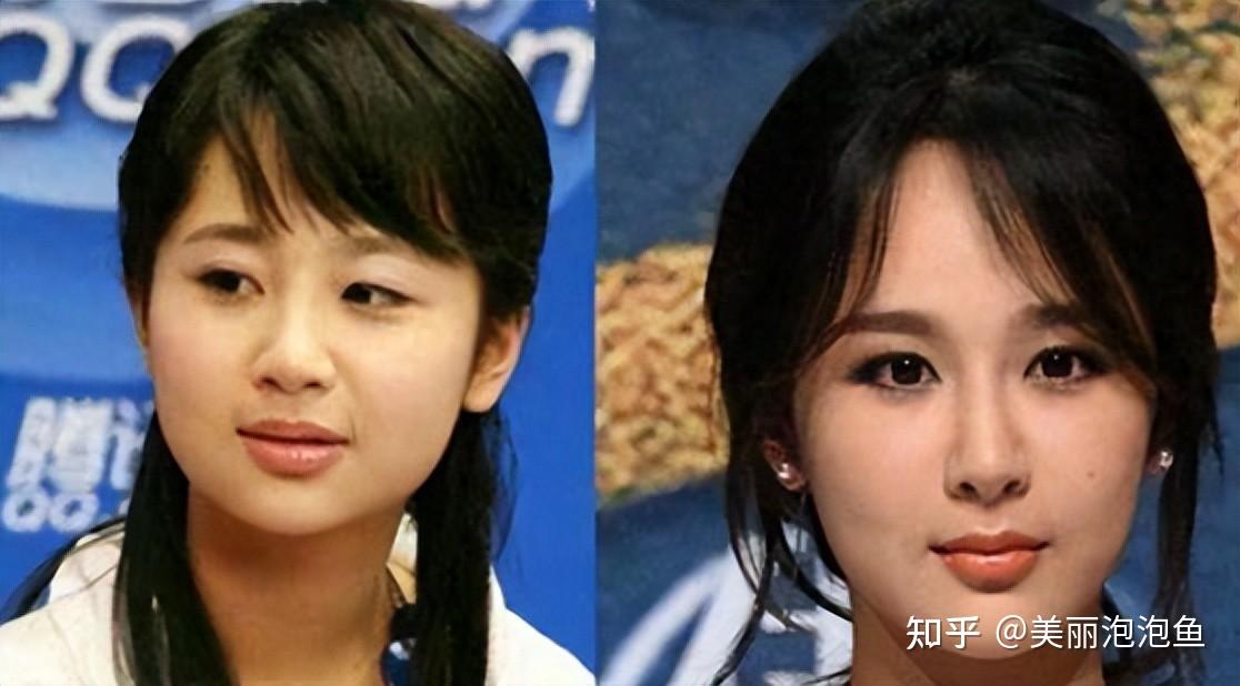 盘点剧中"整容脸"女明星,嘴歪脸肿,表情"尴尬"拖累剧情