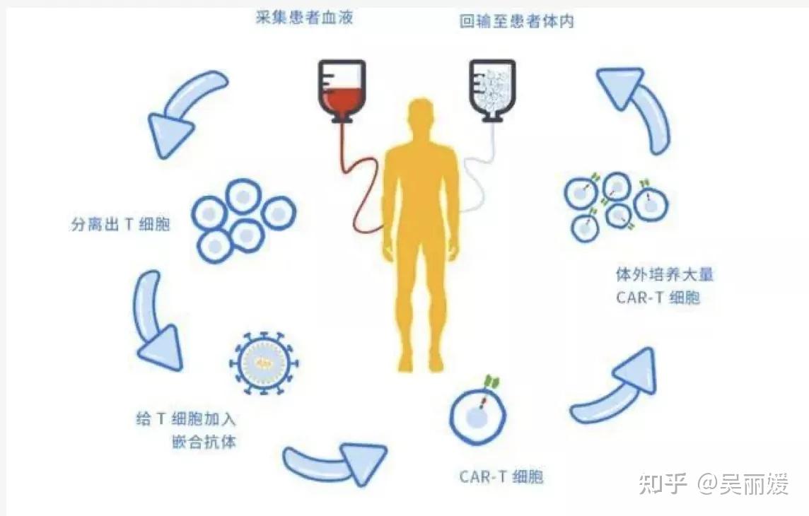 从癌症患者身上分离免疫t细胞;2.
